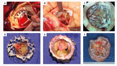 DOI: 10.33963/KP.a2023.0026