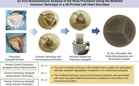 DOI: 10.1016/j.jtcvs.2021.06.070