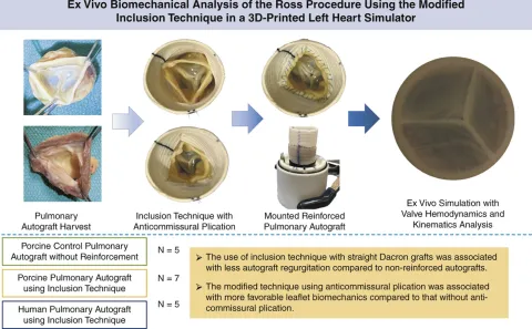 DOI: 10.1016/j.jtcvs.2021.06.070